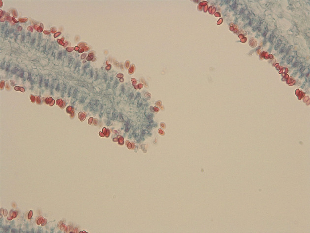 Coprinus Slides - Coprinus 02 400X